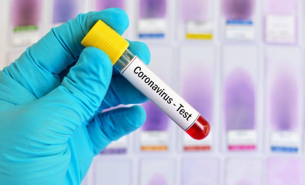 شناسایی 47 مورد جدید مبتلا به کرونا ویروس در ایلام